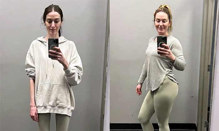 اکتومورف بانوان بانوان اکتومورف